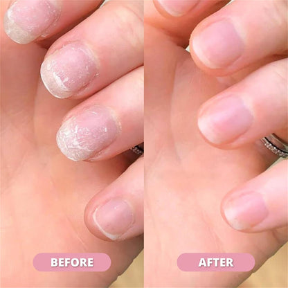 Nail Growth & Cuticle Oil Pen