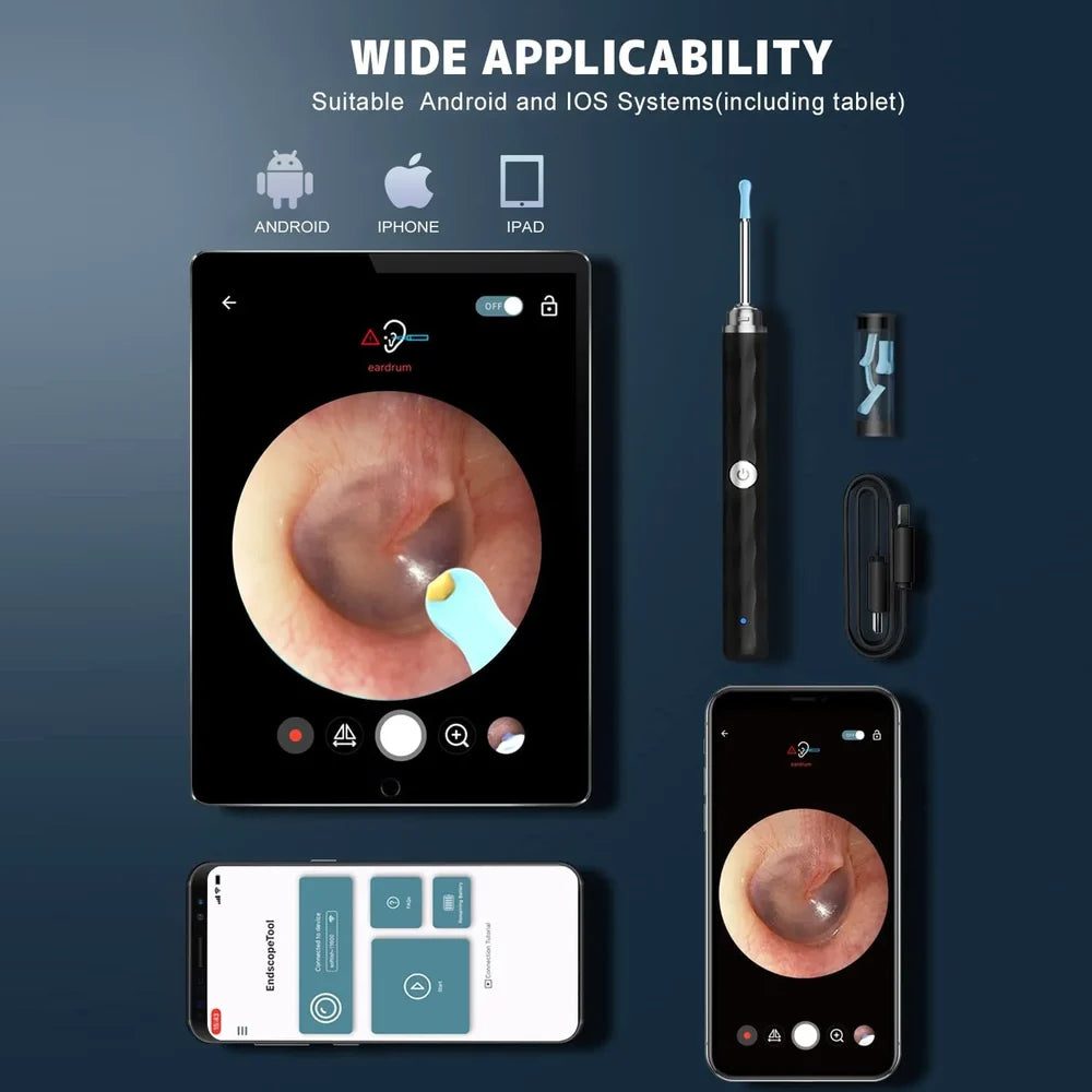 Ear Cleaner High Precision Ear Wax Removal Tool with Camera with LED Light