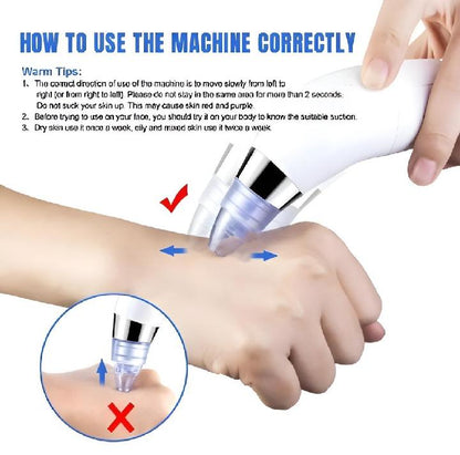 1 Pc Easy-To-Clean Derma Suction Facial Cleanser for Radiant Skin