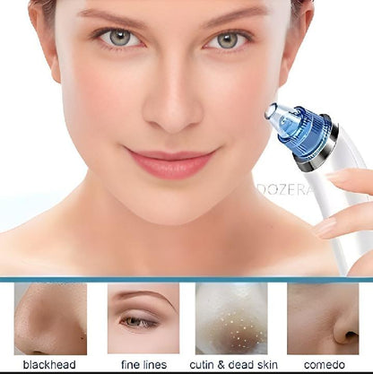 1 Pc Easy-To-Clean Derma Suction Facial Cleanser for Radiant Skin