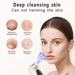 Acne Black Head Deep Clean Removal